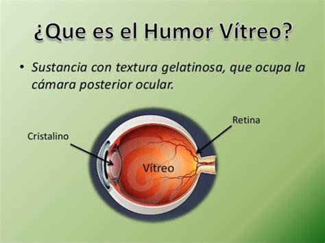 humor vitreo-4